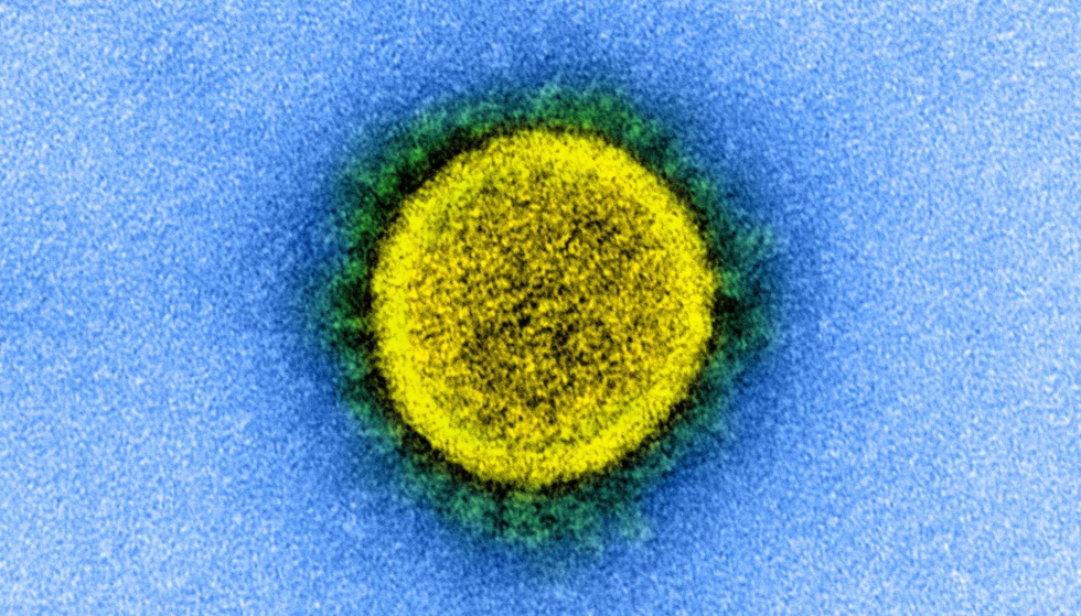 Otra imagen del coronavirus SARS-CoV-2