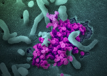 Letalidad, test y rastreo: los números del coronavirus esta semana
