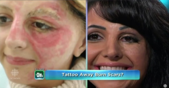 Vídeo: Tatuajes para esconder (y curar) cicatrices | Verne EL PAÍS