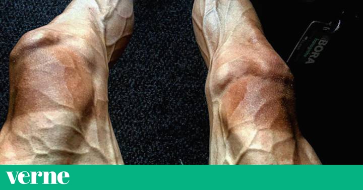 Vascularizacion pierna