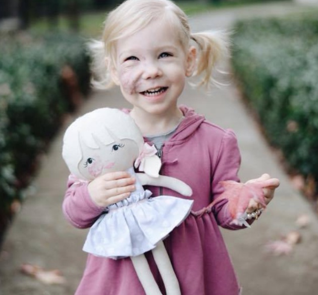 Sotavento nacionalismo pedazo Esta niña recibe como regalo de Navidad una muñeca con su misma marca en la  cara | Verne EL PAÍS